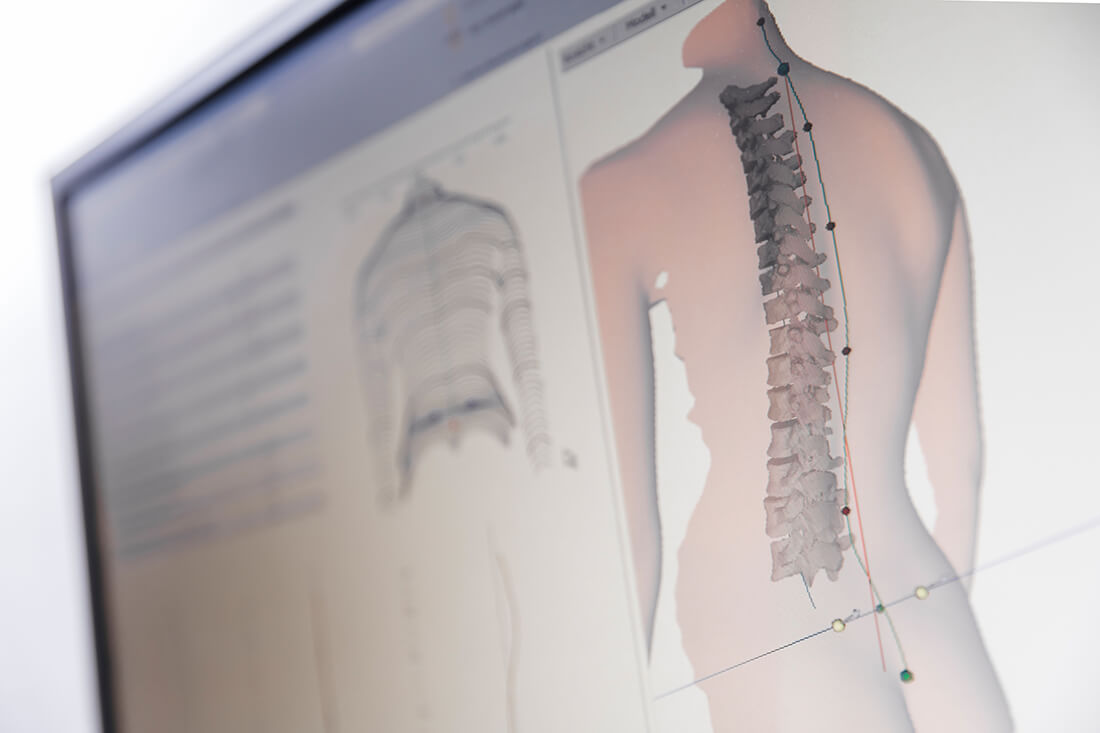 Orthopädie Meerbusch - Vollmert - Potrett - Leistungen - Wirbelsäulentherapie